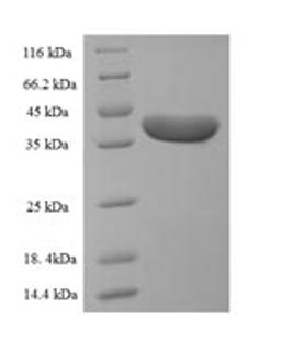 (Tris-Glycine gel) Discontinuous SDS-PAGE (reduced) with 5% enrichment gel and 15% separation gel.