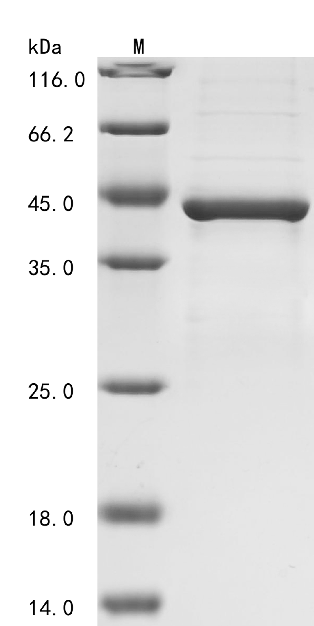 (Tris-Glycine gel) Discontinuous SDS-PAGE (reduced) with 5% enrichment gel and 15% separation gel.
