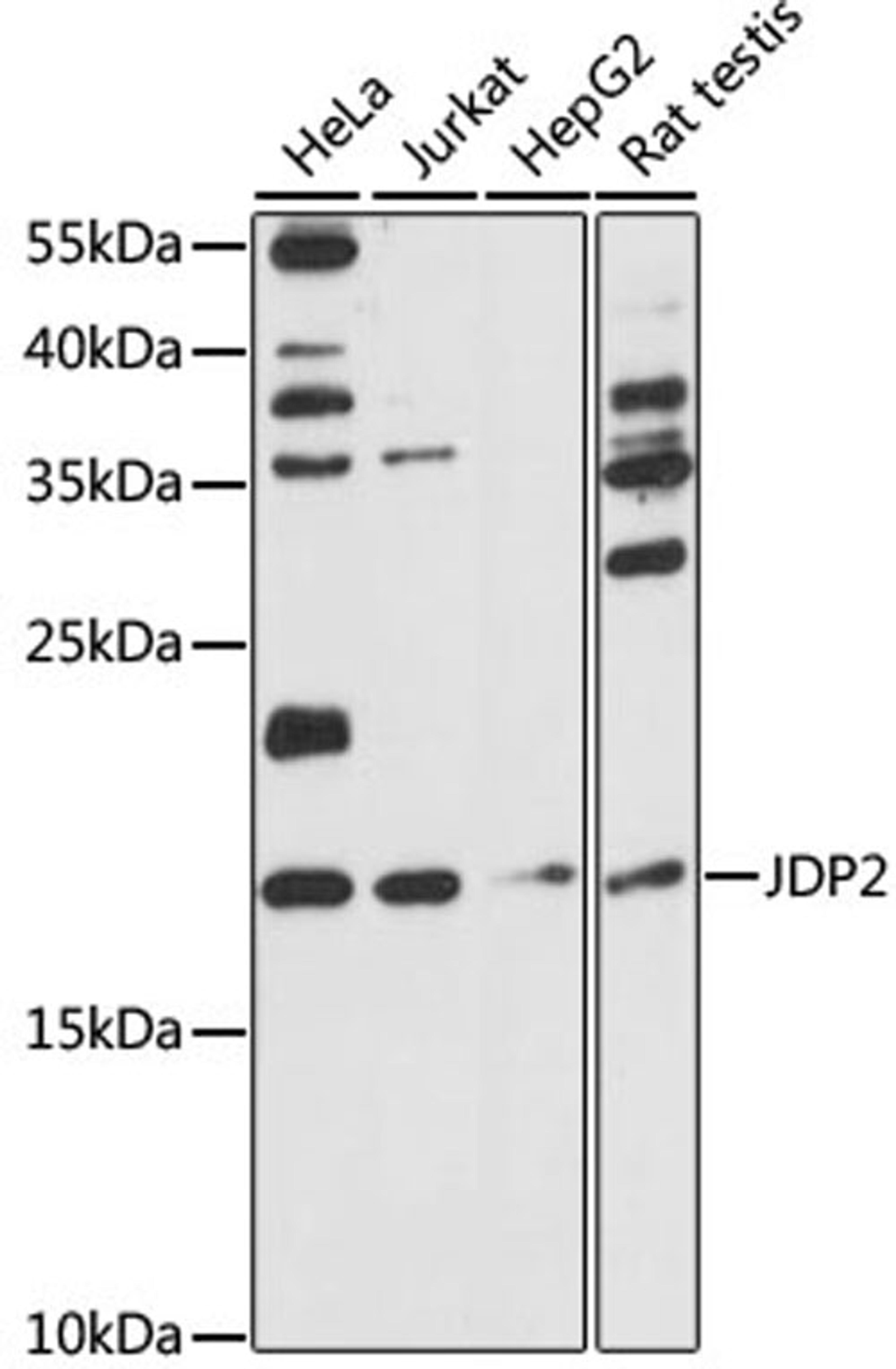 Western blot - JDP2 antibody (A15208)