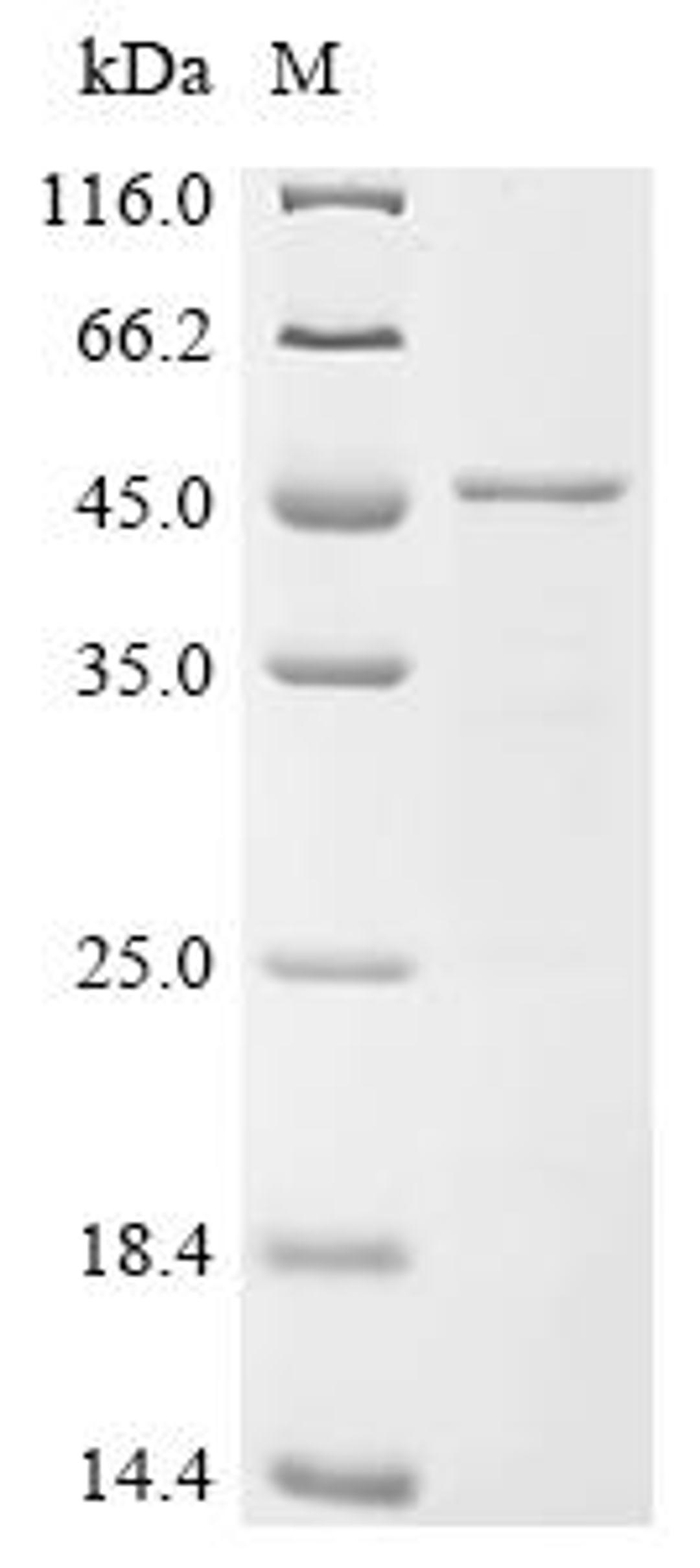 (Tris-Glycine gel) Discontinuous SDS-PAGE (reduced) with 5% enrichment gel and 15% separation gel.