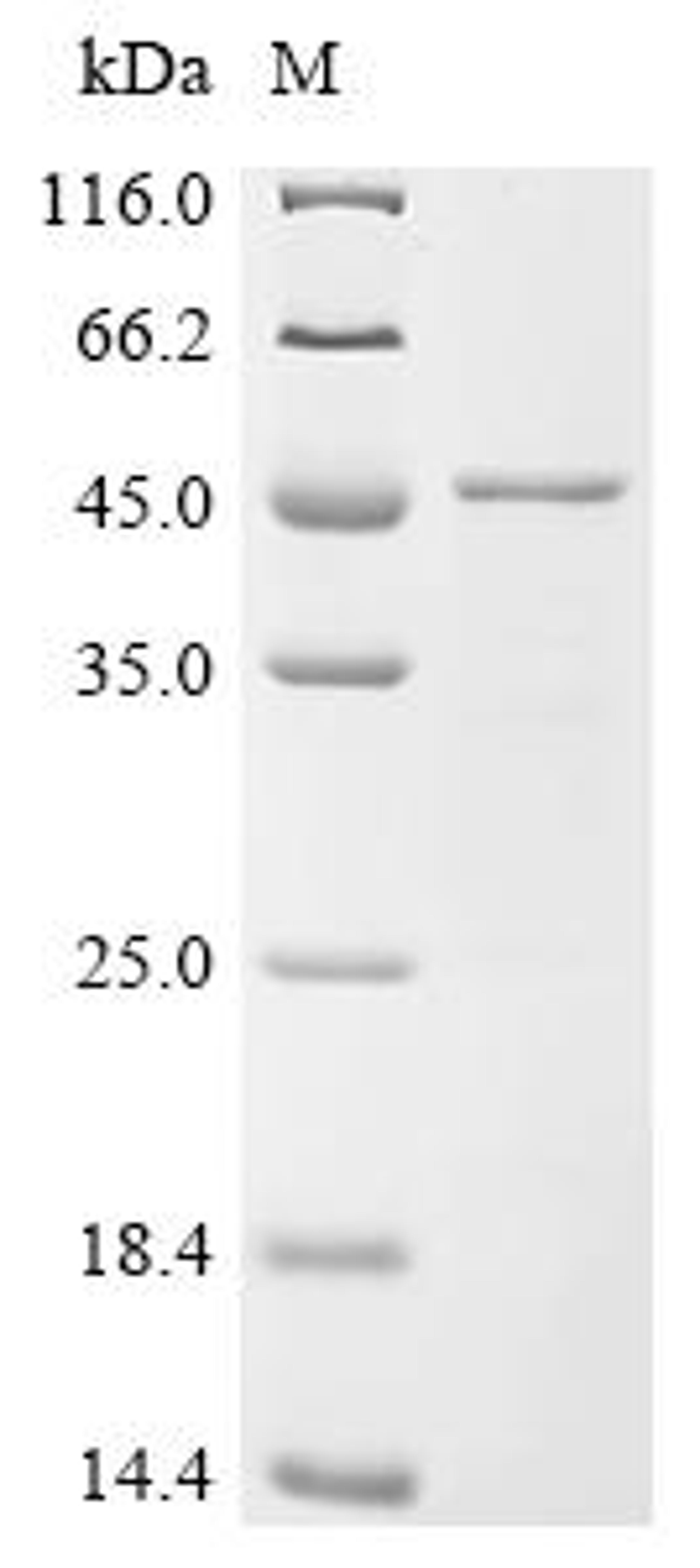 (Tris-Glycine gel) Discontinuous SDS-PAGE (reduced) with 5% enrichment gel and 15% separation gel.