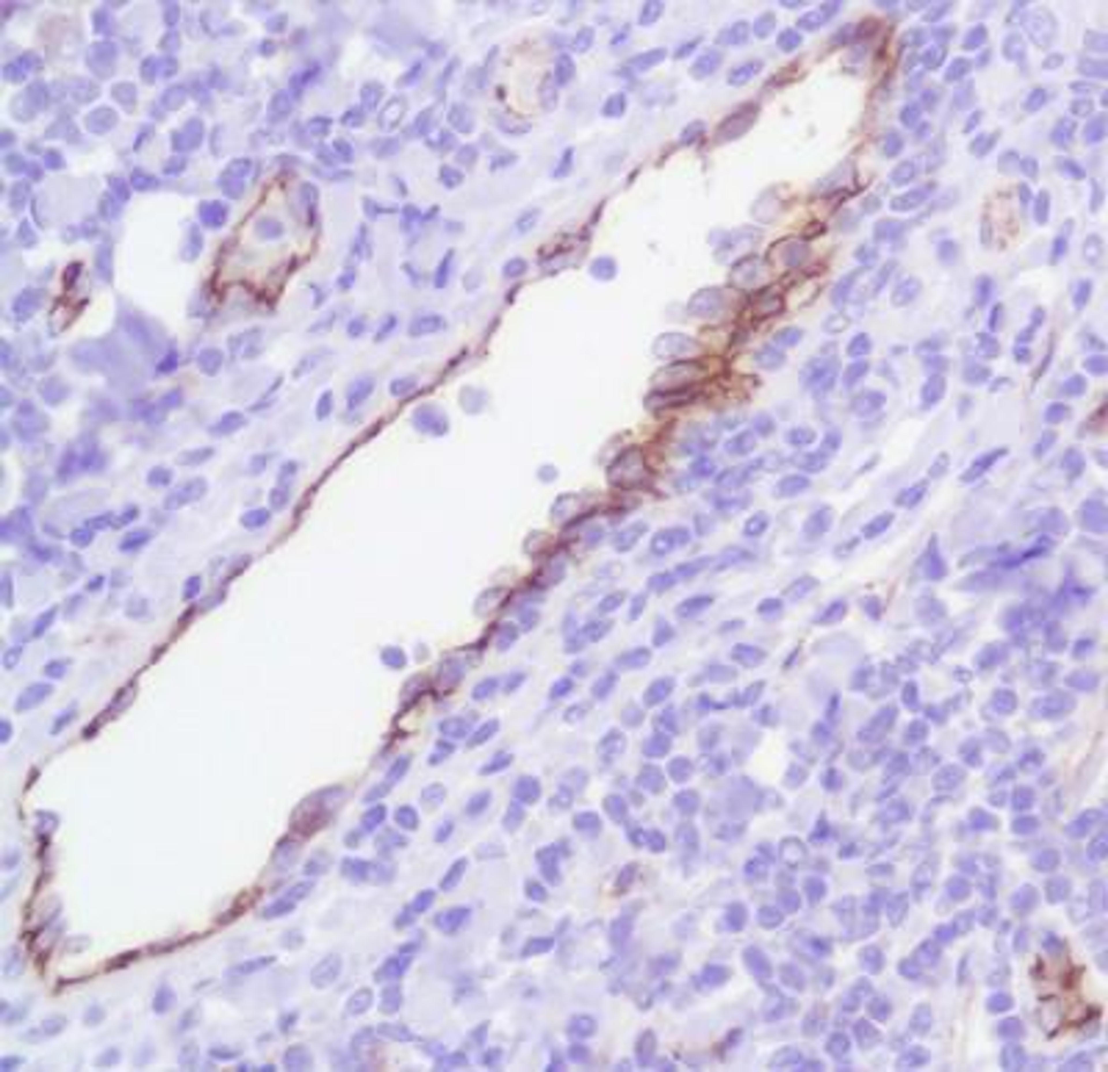 Immunohistochemistry-Paraffin: CD31/PECAM-1 Antibody (SP38) [NBP1-49805] - Human Tonsil