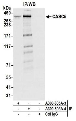 Detection of human CASC5 by western blot of immunoprecipitates.