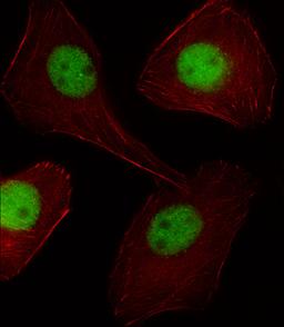 Fluorescent image of U251 cell stained with PGR/PR Antibody .U251 cells were fixed with 4% PFA (20 min), permeabilized with Triton X-100 (0.1%, 10 min), then incubated with PGR/PR primary antibody (1:25). For secondary antibody, Alexa Fluor 488 conjugated