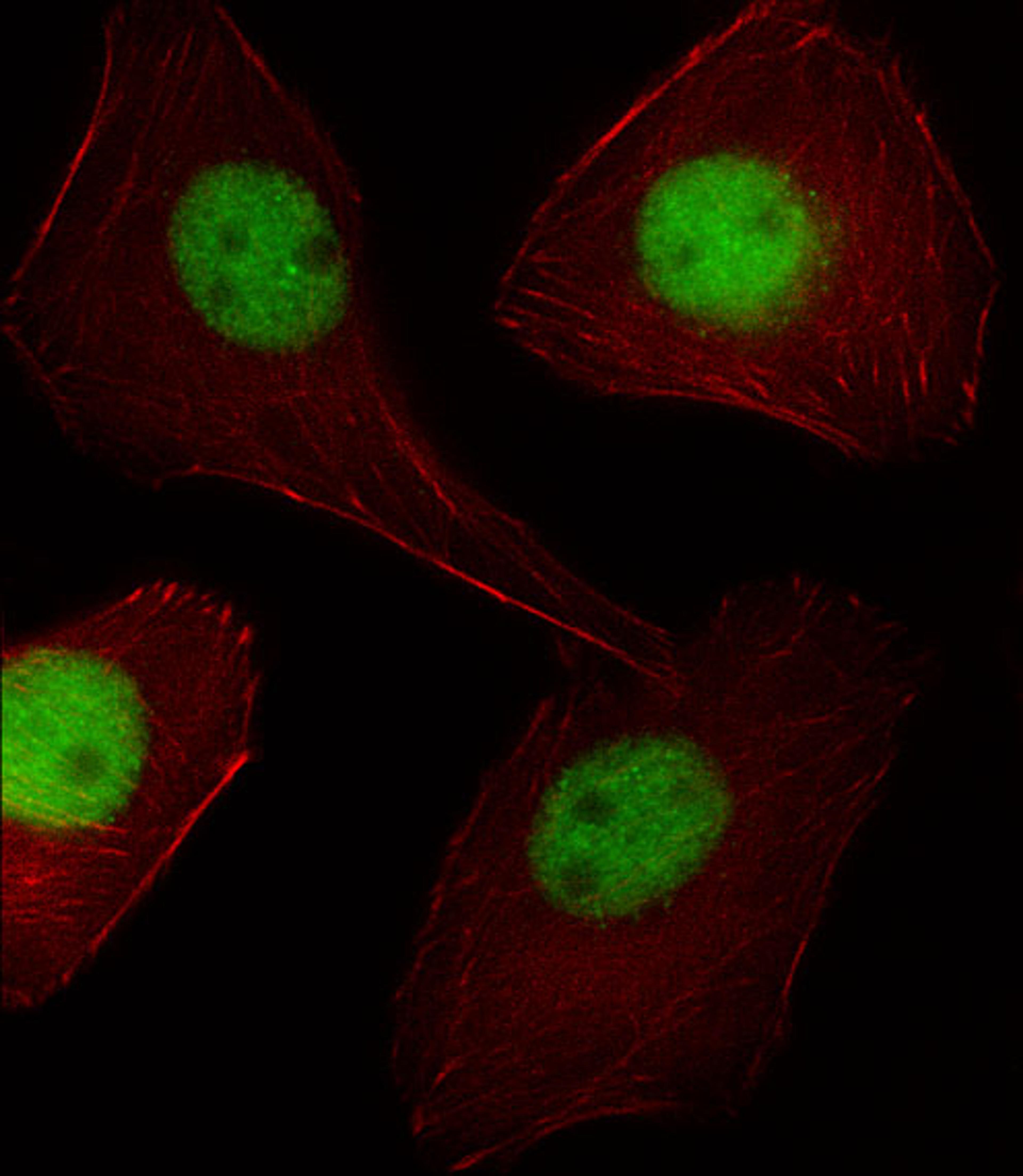 Fluorescent image of U251 cell stained with PGR/PR Antibody .U251 cells were fixed with 4% PFA (20 min), permeabilized with Triton X-100 (0.1%, 10 min), then incubated with PGR/PR primary antibody (1:25). For secondary antibody, Alexa Fluor 488 conjugated