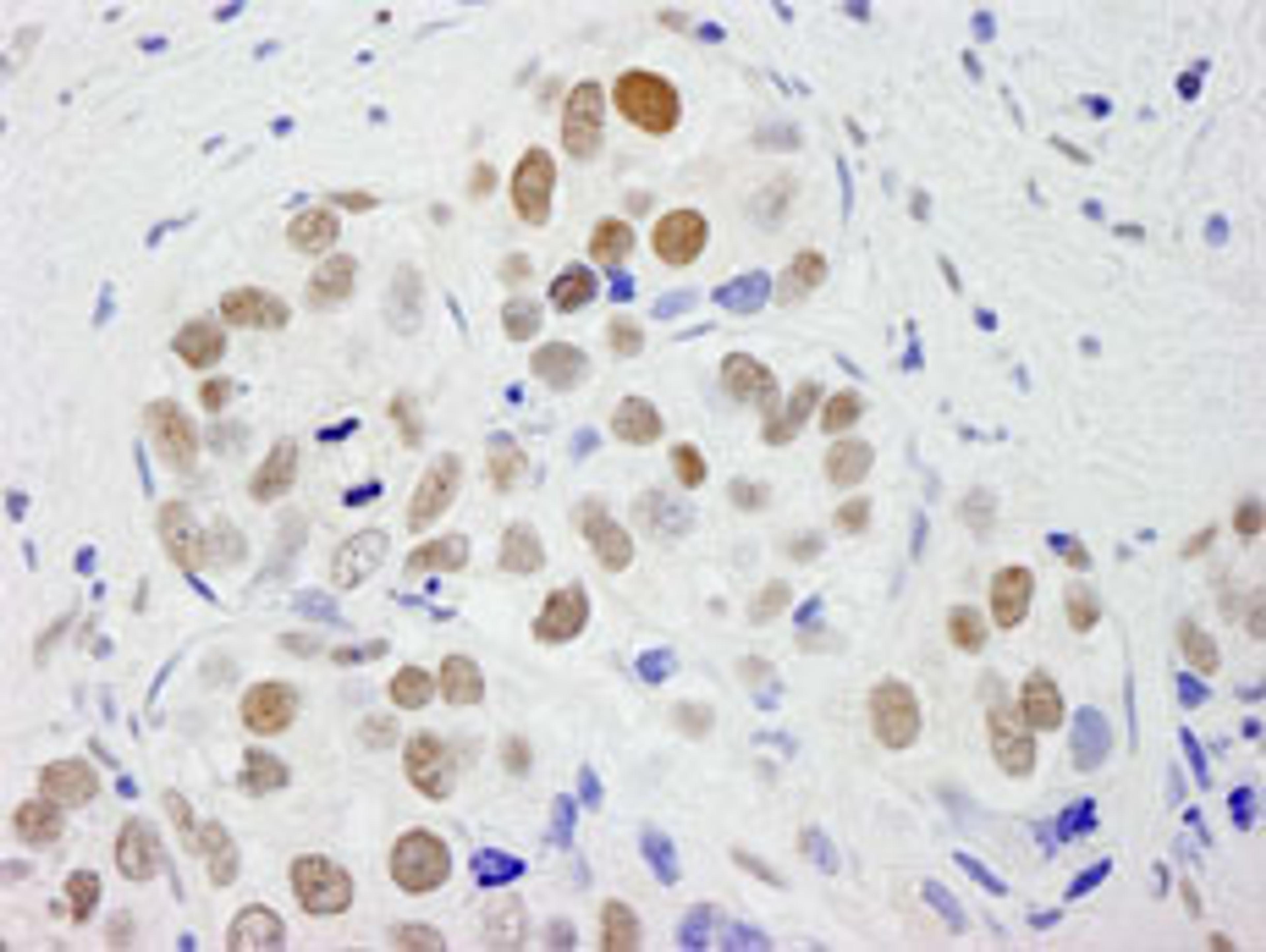 Detection of human CPSF59 by immunohistochemistry.