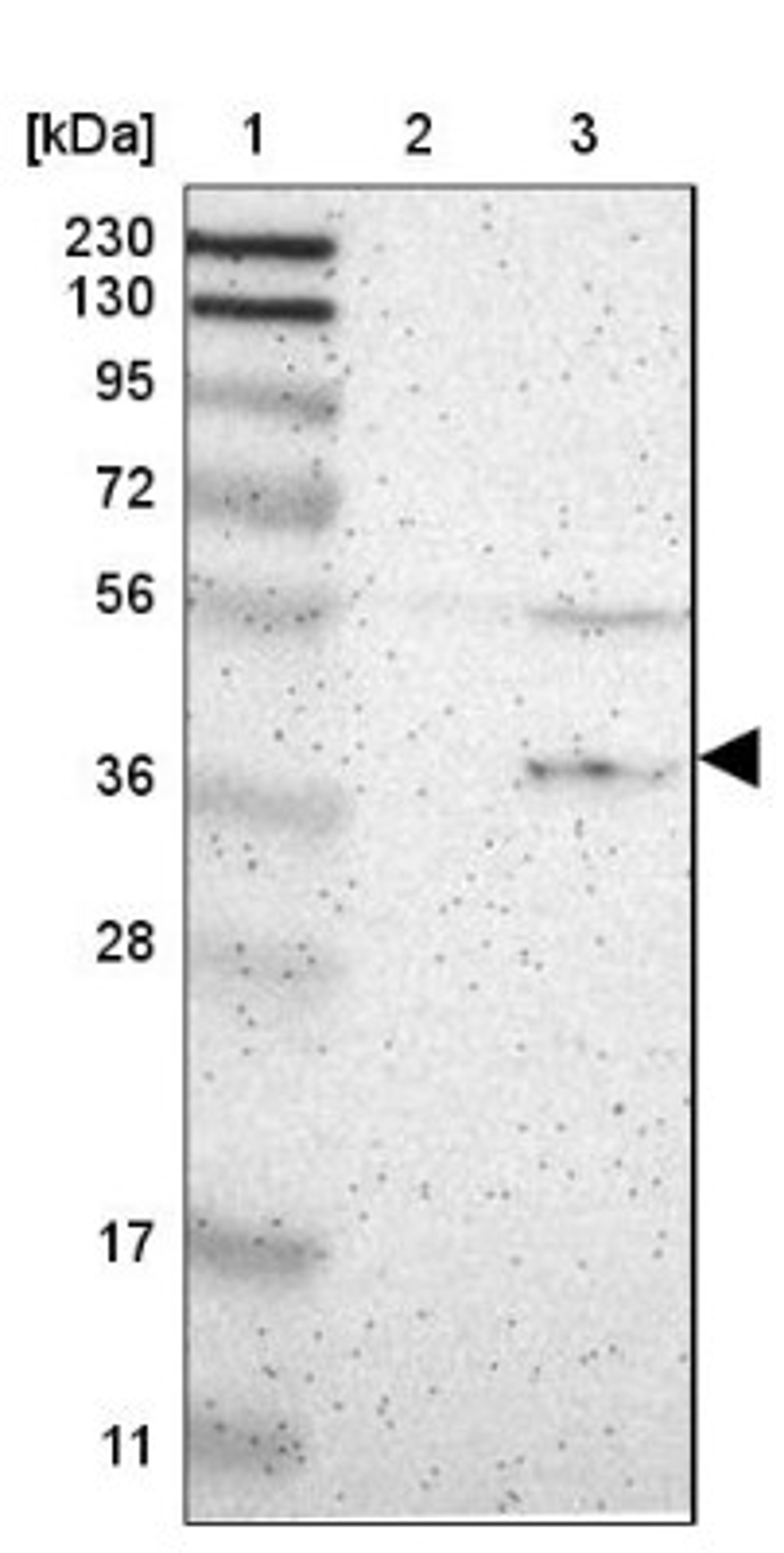 Western Blot: G protein alpha Inhibitor 2 Antibody [NBP1-89771] - Lane 1: Marker [kDa] 230, 130, 95, 72, 56, 36, 28, 17, 11<br/>Lane 2: Human cell line RT-4<br/>Lane 3: Human cell line U-251MG sp