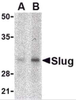 Western blot analysis of Slug in human kidney cell lysate with Slug antibody at in (A) 1 and (B) 2 &#956;g/mL.