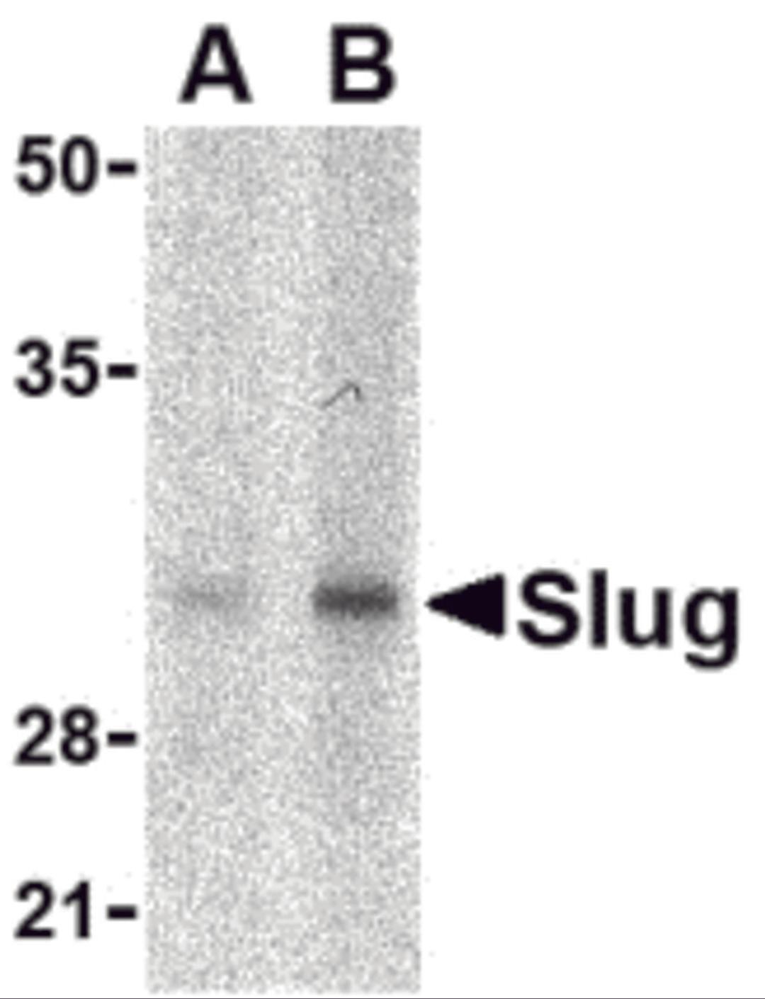 Western blot analysis of Slug in human kidney cell lysate with Slug antibody at in (A) 1 and (B) 2 μg/mL.