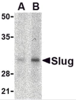 Western blot analysis of Slug in human kidney cell lysate with Slug antibody at in (A) 1 and (B) 2 μg/mL.