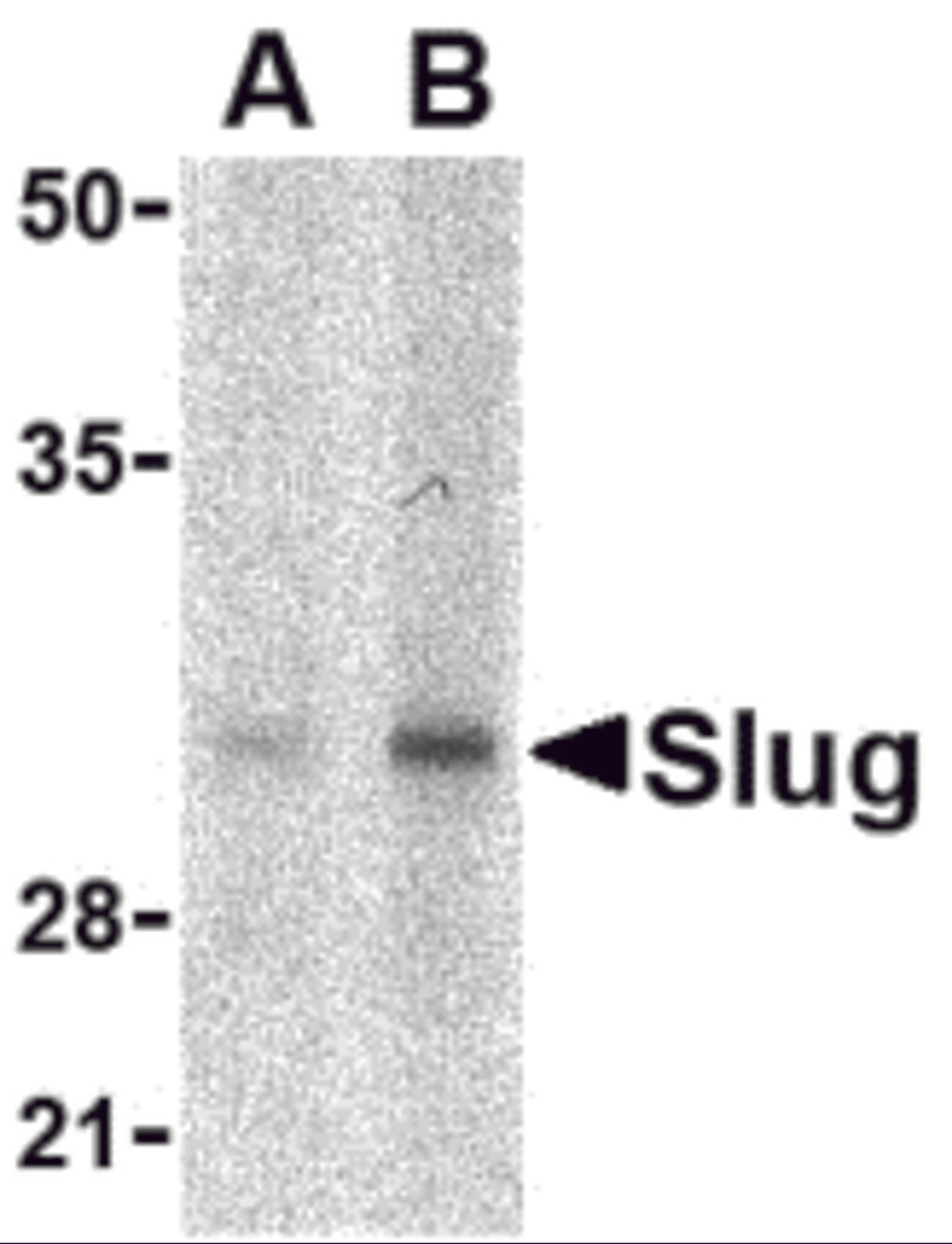Western blot analysis of Slug in human kidney cell lysate with Slug antibody at in (A) 1 and (B) 2 μg/mL.