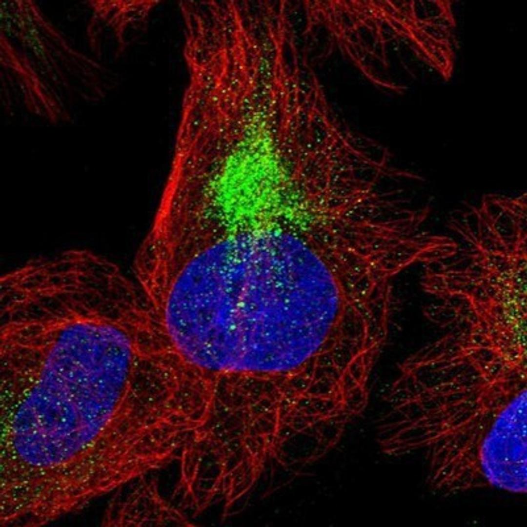 Immunocytochemistry/Immunofluorescence: CCDC125 Antibody [NBP1-93660] - Staining of human cell line U-2 OS shows positivity in cytoskeleton (intermediate filaments).