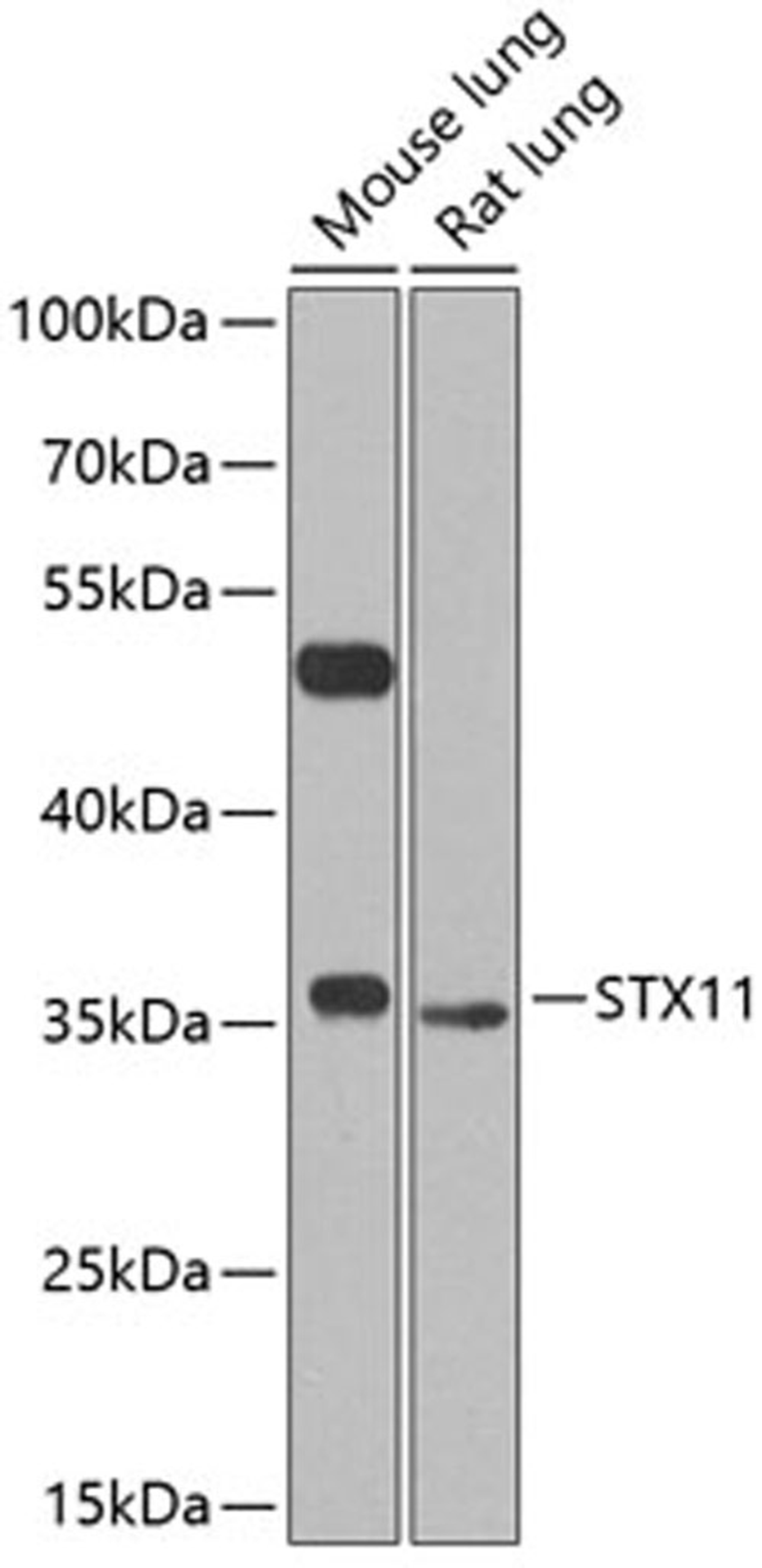 Western blot - STX11 antibody (A8169)