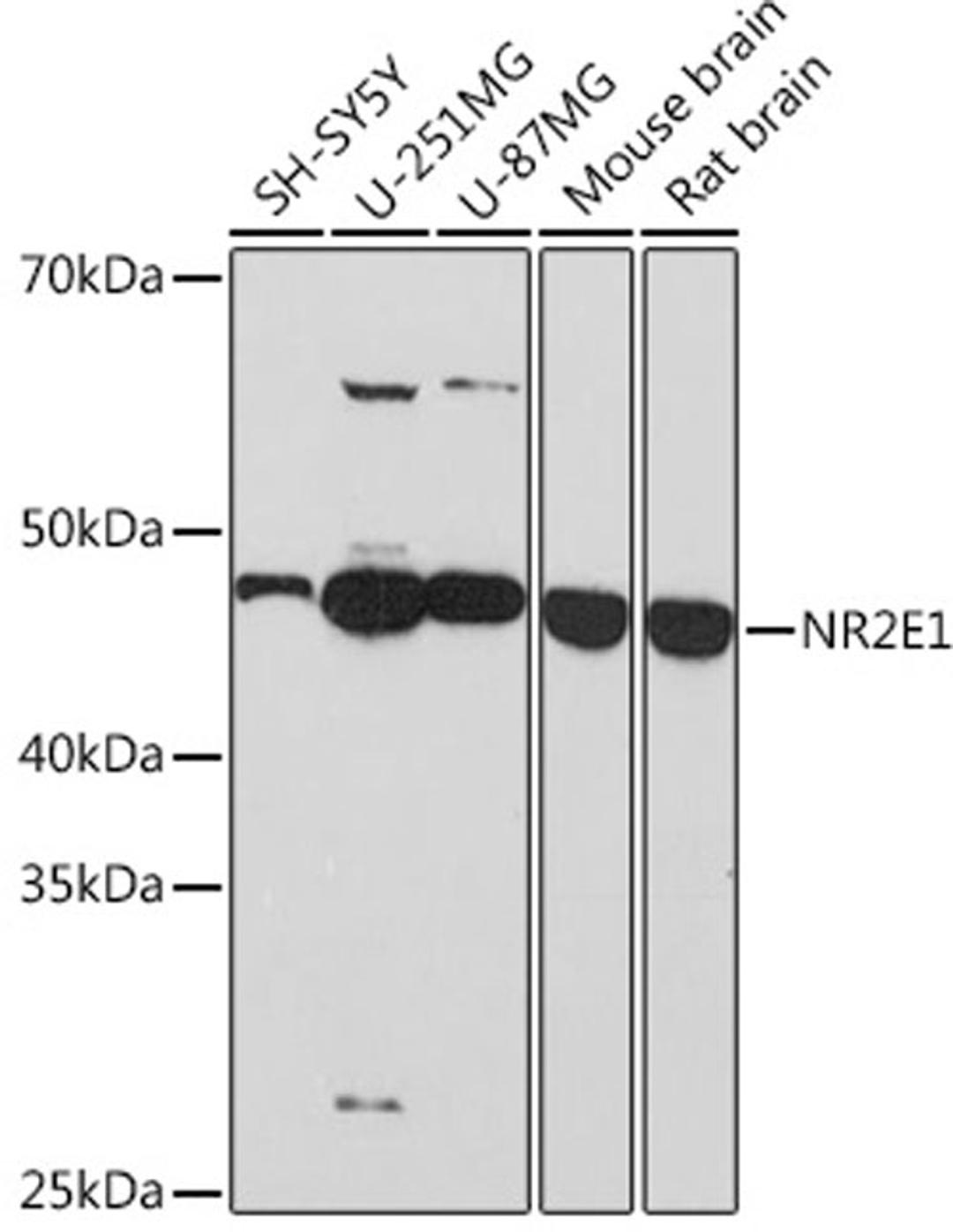 Western blot - NR2E1 Rabbit mAb (A8768)