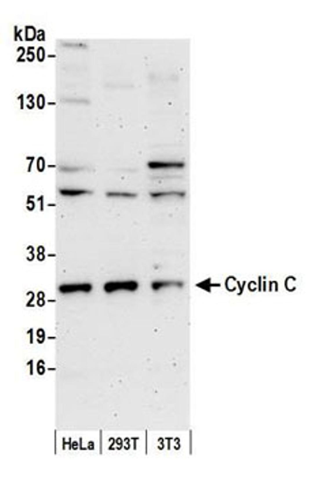 Detection of human and mouse Cyclin C by western blot.