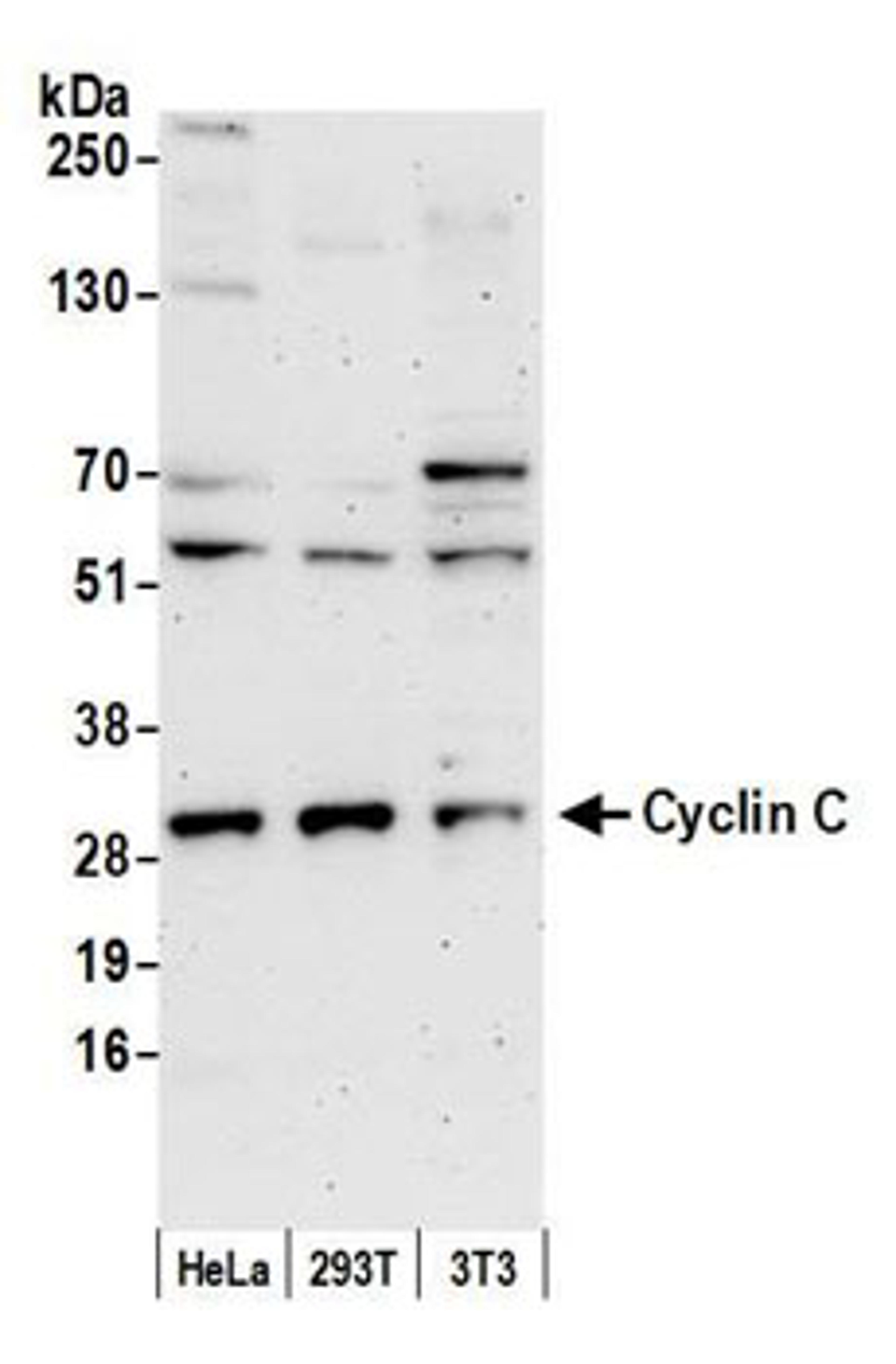 Detection of human and mouse Cyclin C by western blot.