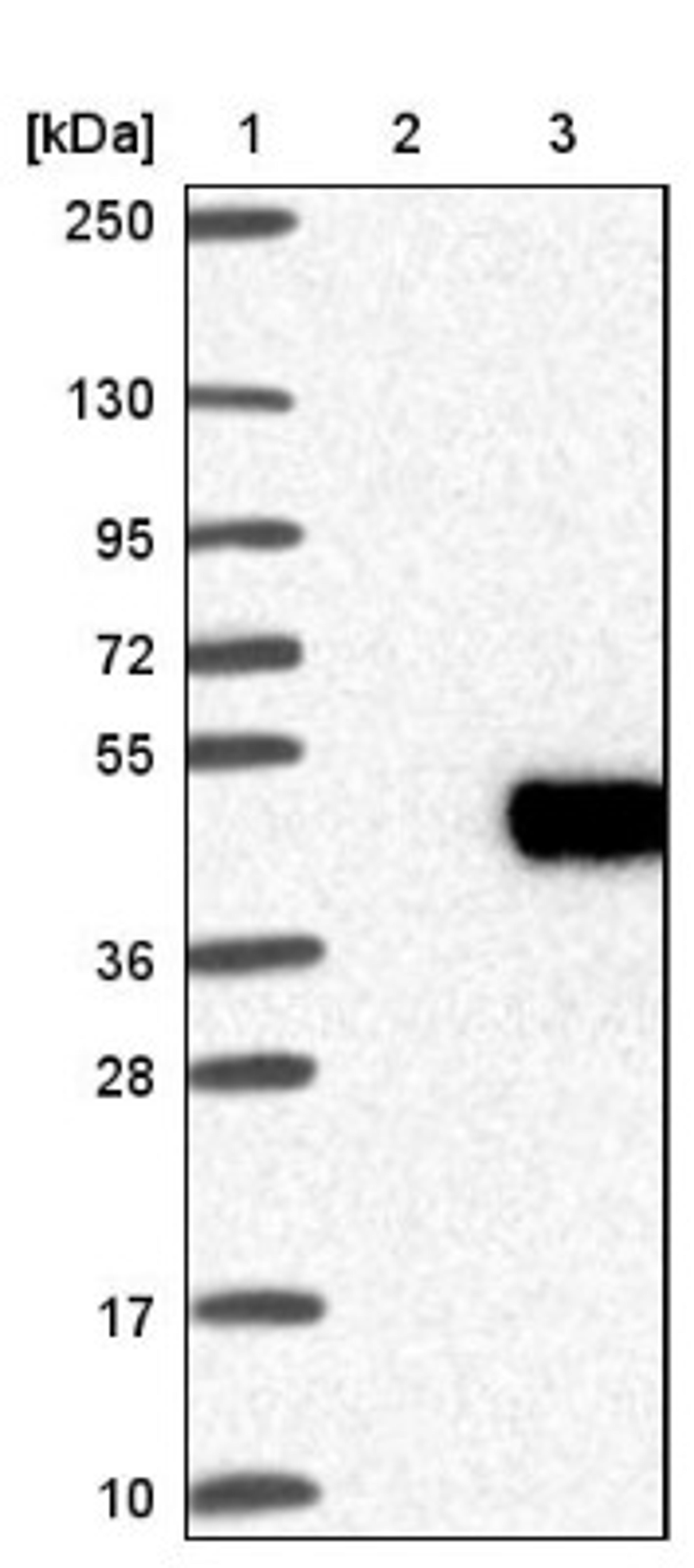 Western Blot: RNASET2 Antibody [NBP1-88753] - Lane 1: Marker [kDa] 250, 130, 95, 72, 55, 36, 28, 17, 10<br/>Lane 2: Negative control (vector only transfected HEK293T lysate)<br/>Lane 3: Over-expression lysate (Co-expressed with a C-terminal myc-DDK tag (~3.1 kDa) in mammalian HEK293T cells, LY418470)