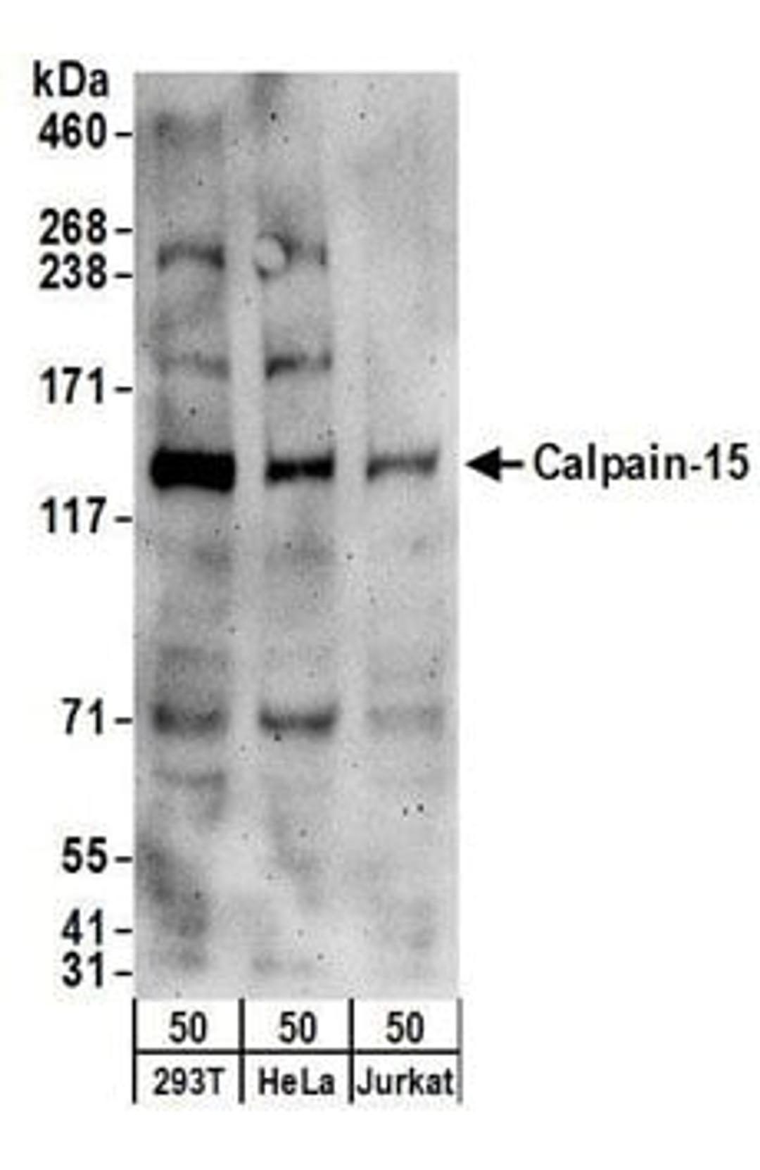 Detection of human Calpain-15 by western blot.