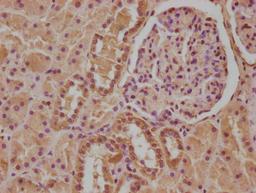IHC image of CSB-PA011591LA01HU diluted at 1:100 and staining in paraffin-embedded human kidney tissue performed on a Leica BondTM system. After dewaxing and hydration, antigen retrieval was mediated by high pressure in a citrate buffer (pH 6.0). Section was blocked with 10% normal goat serum 30min at RT. Then primary antibody (1% BSA) was incubated at 4°C overnight. The primary is detected by a biotinylated secondary antibody and visualized using an HRP conjugated SP system.