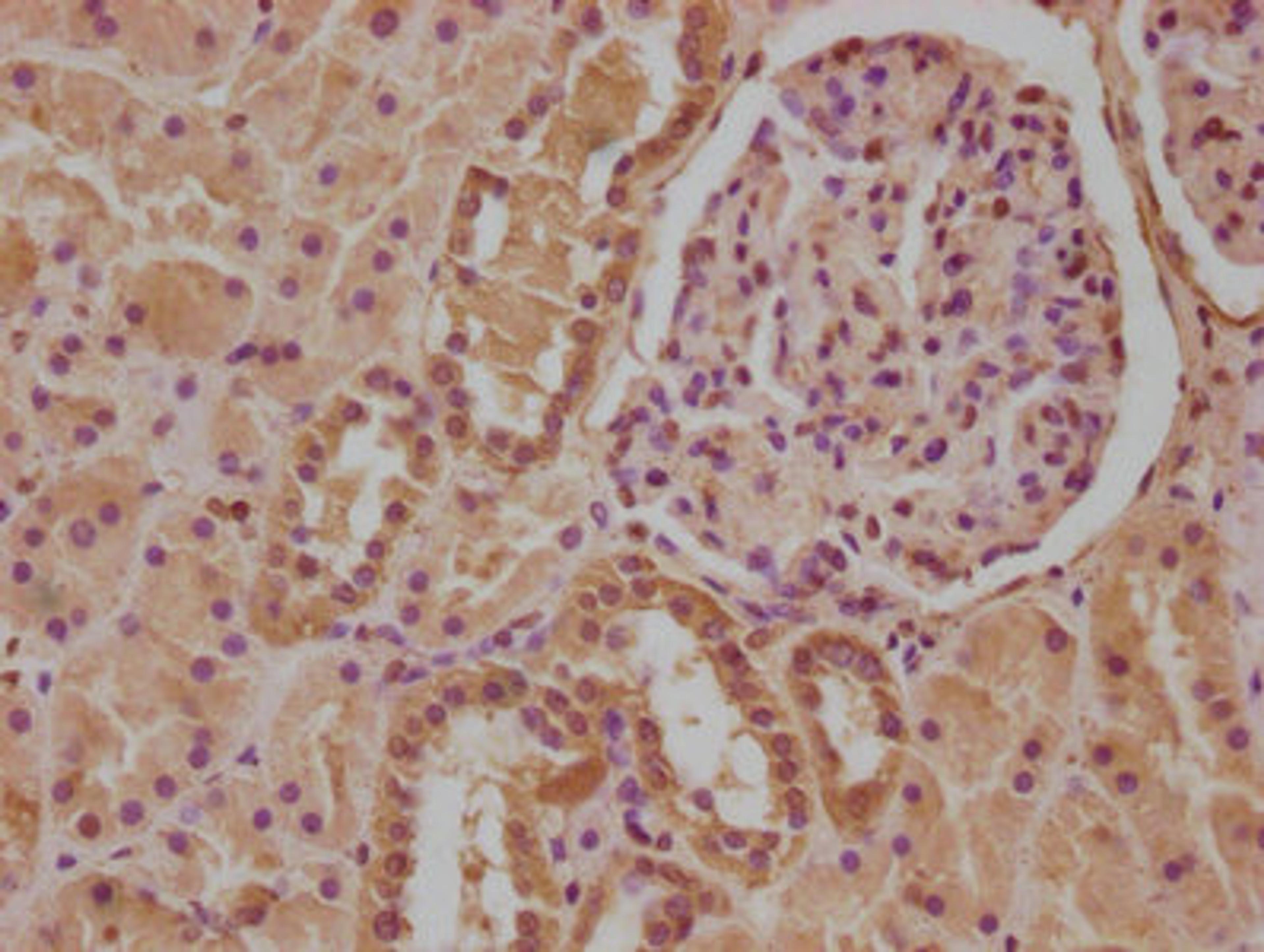 IHC image of CSB-PA011591LA01HU diluted at 1:100 and staining in paraffin-embedded human kidney tissue performed on a Leica BondTM system. After dewaxing and hydration, antigen retrieval was mediated by high pressure in a citrate buffer (pH 6.0). Section was blocked with 10% normal goat serum 30min at RT. Then primary antibody (1% BSA) was incubated at 4°C overnight. The primary is detected by a biotinylated secondary antibody and visualized using an HRP conjugated SP system.