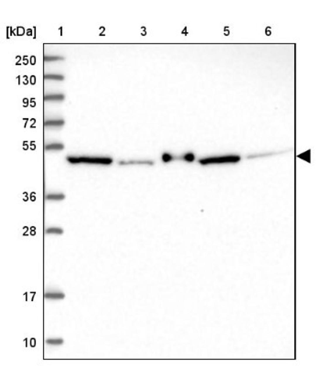 Western Blot: Ferredoxin Reductase Antibody [NBP2-38530] - Lane 1: Marker [kDa] 250, 130, 95, 72, 55, 36, 28, 17, 10<br/>Lane 2: RT-4<br/>Lane 3: U-251 MG<br/>Lane 4: Human Plasma<br/>Lane 5: Liver<br/>Lane 6: Tonsil