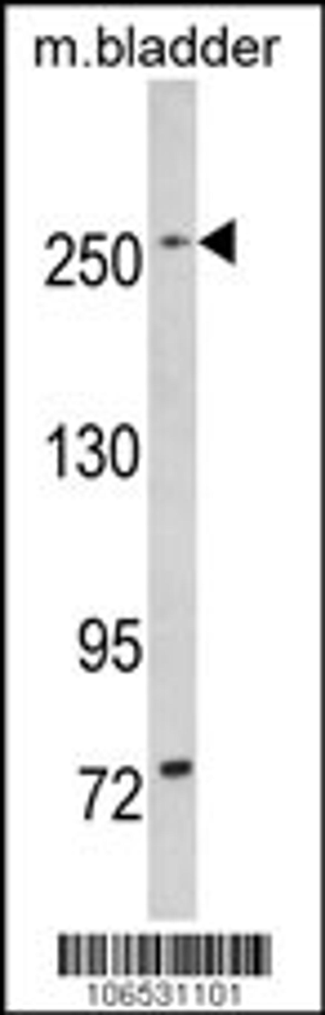 Western blot analysis of LRRK1 in mouse bladder tissue lysates (35ug/lane)