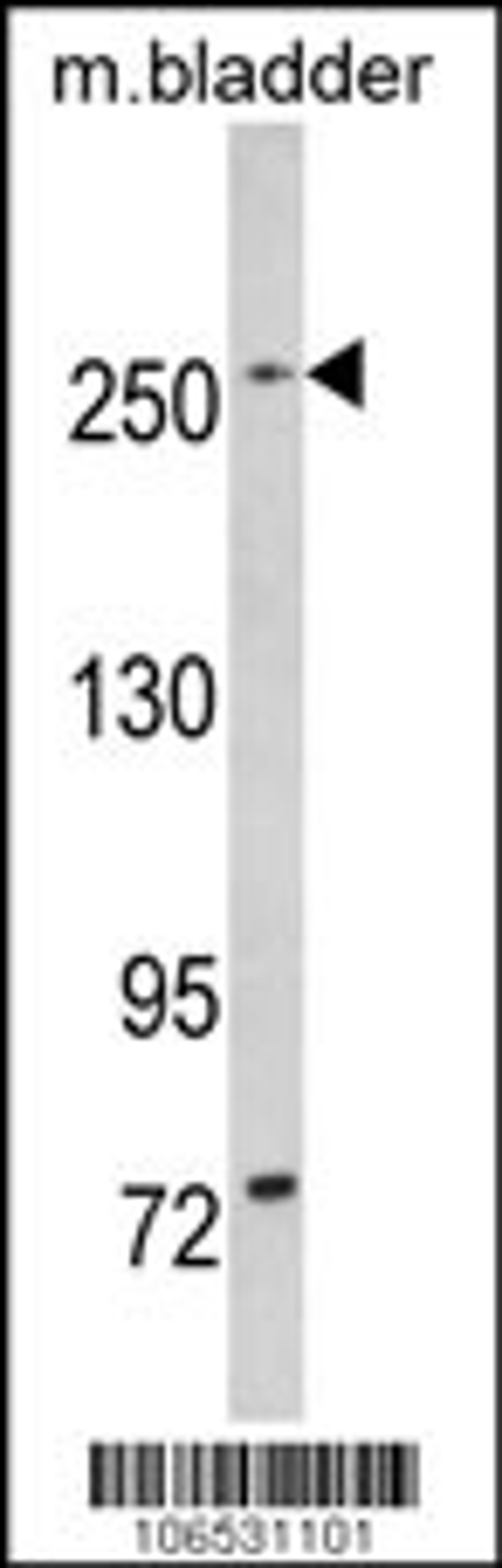 Western blot analysis of LRRK1 in mouse bladder tissue lysates (35ug/lane)