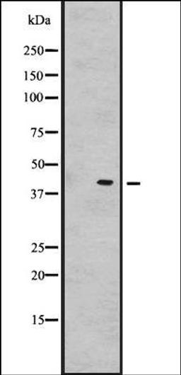 Western blot analysis of Hela cell lysate using GNRHR2 antibody