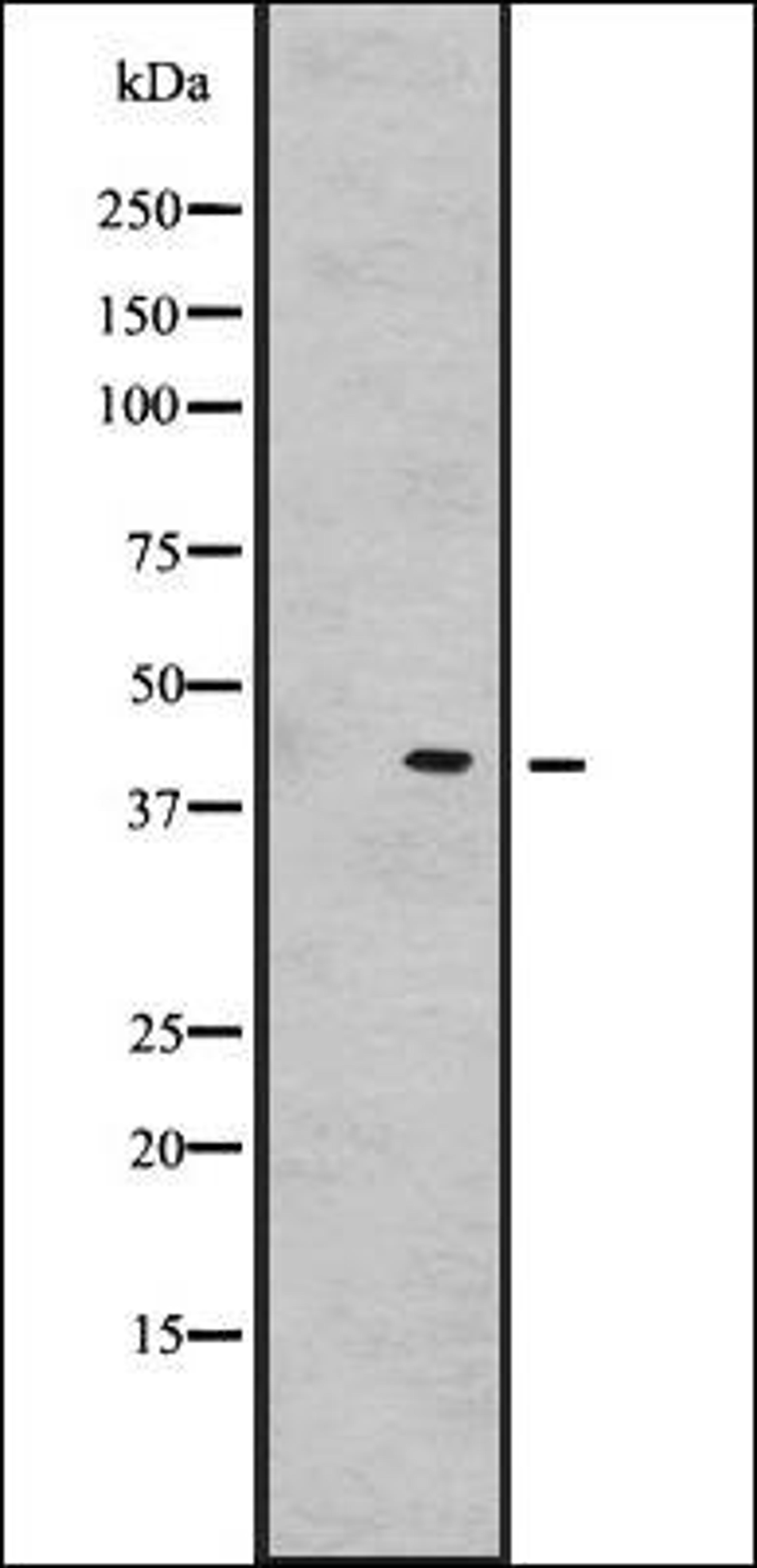 Western blot analysis of Hela cell lysate using GNRHR2 antibody