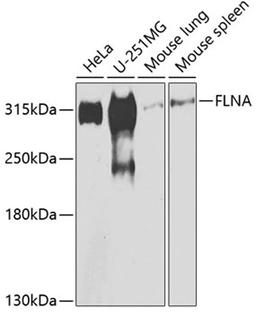 Western blot - FLNA antibody (A7896)