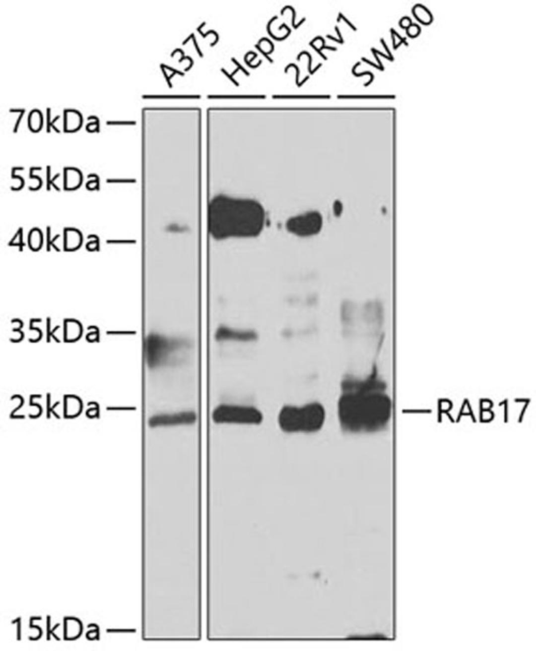 Western blot - RAB17 antibody (A7831)