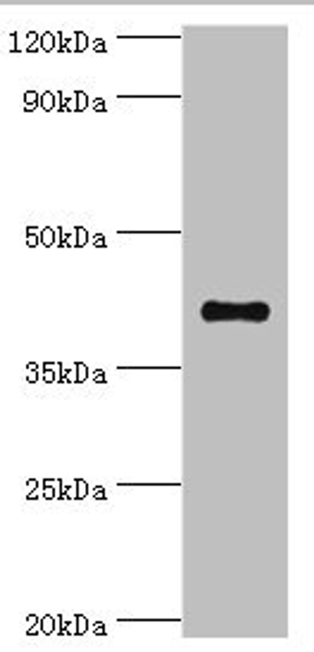 Western blot. All lanes: Sulfotransferase family cytosolic 2B member 1 antibody at 4ug/ml + MCF-7 whole cell lysate. Secondary. Goat polyclonal to rabbit IgG at 1/10000 dilution. Predicted band size: 42, 40 kDa. Observed band size: 42 kDa. 