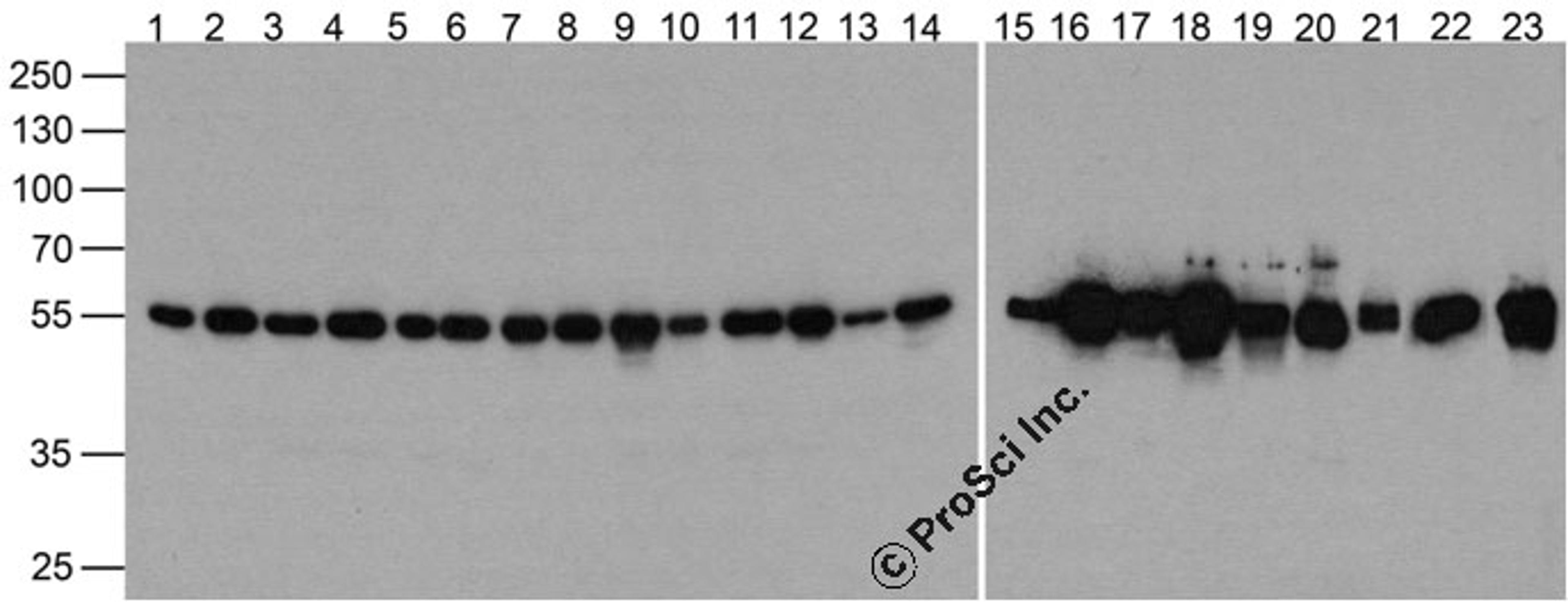 Western blot of alpha-Tubulin in 293, A431, A549, Daudi, HeLa, HepG2, Jurkat, K562, MOLT4, 3T3, Raji, Ramos, THP-1, U937, human brain, mouse brain, rat brain, rabbit brain, mouse lung, rat lung, mouse liver, rabbit spleen and zebrafish lysate at 1 μg