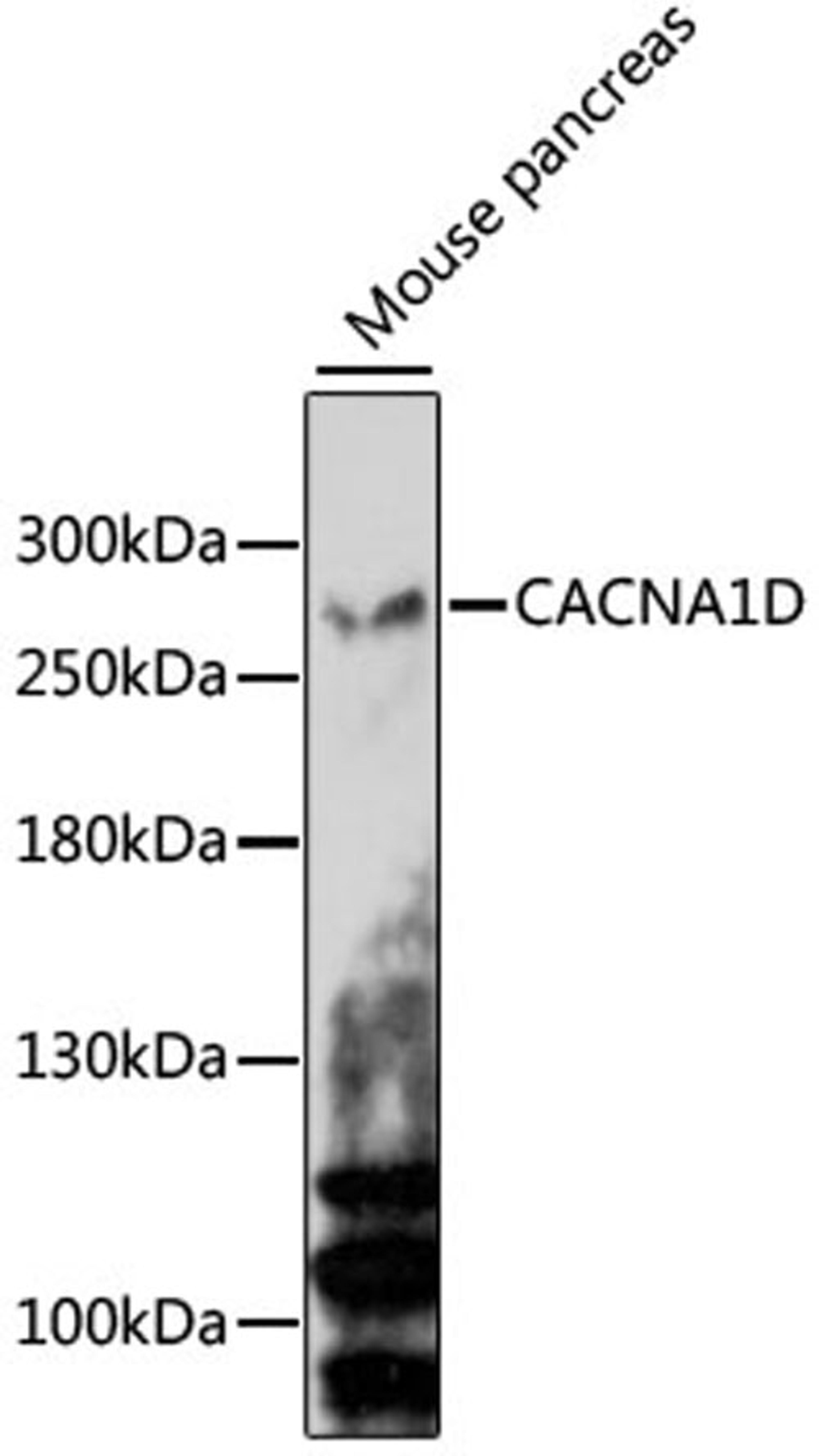 Western blot - CACNA1D antibody (A15034)