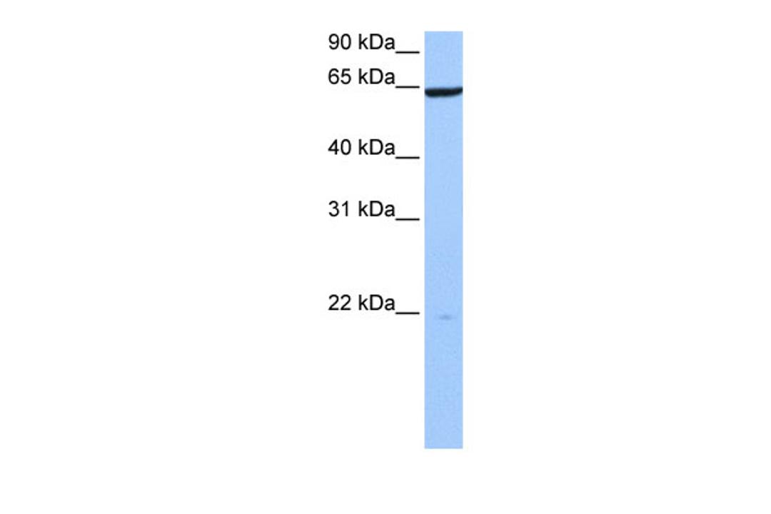 Antibody used in WB on Human 721_B at 0.2-1 ug/ml.