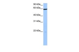 Antibody used in WB on Human 721_B at 0.2-1 ug/ml.