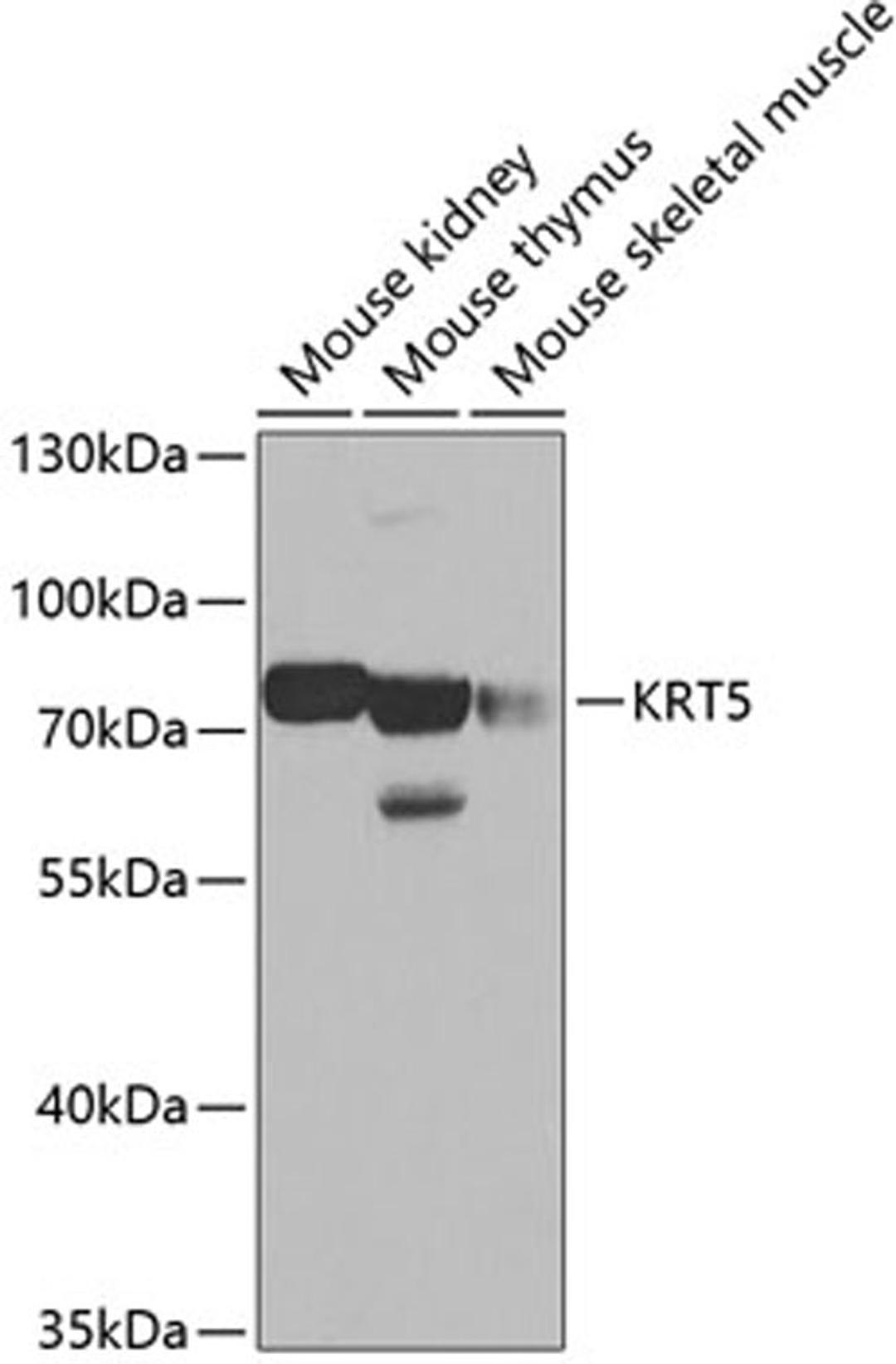 Western blot - KRT5 antibody (A2662)