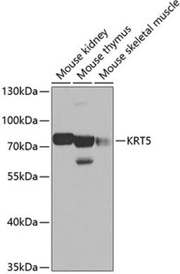 Western blot - KRT5 antibody (A2662)