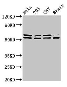 Western Blot. Positive WB detected in: Hela whole cell lysate, 293 whole cell lysate, U87 whole cell lysate, Rat brain tissue. All lanes: CD3EAP antibody at 3.9ug/ml. Secondary. Goat polyclonal to rabbit IgG at 1/50000 dilution. Predicted band size: 55, 56 kDa. Observed band size: 55, 56 kDa.