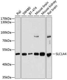 Western blot - SLC1A4 antibody (A12507)