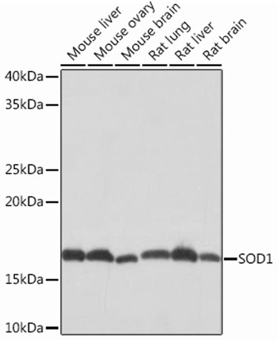 Western blot - SOD1 Rabbit mAb (A12537)