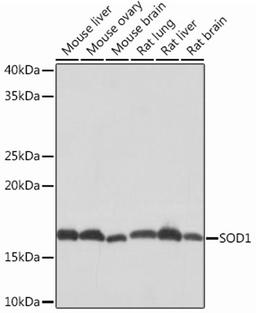 Western blot - SOD1 Rabbit mAb (A12537)