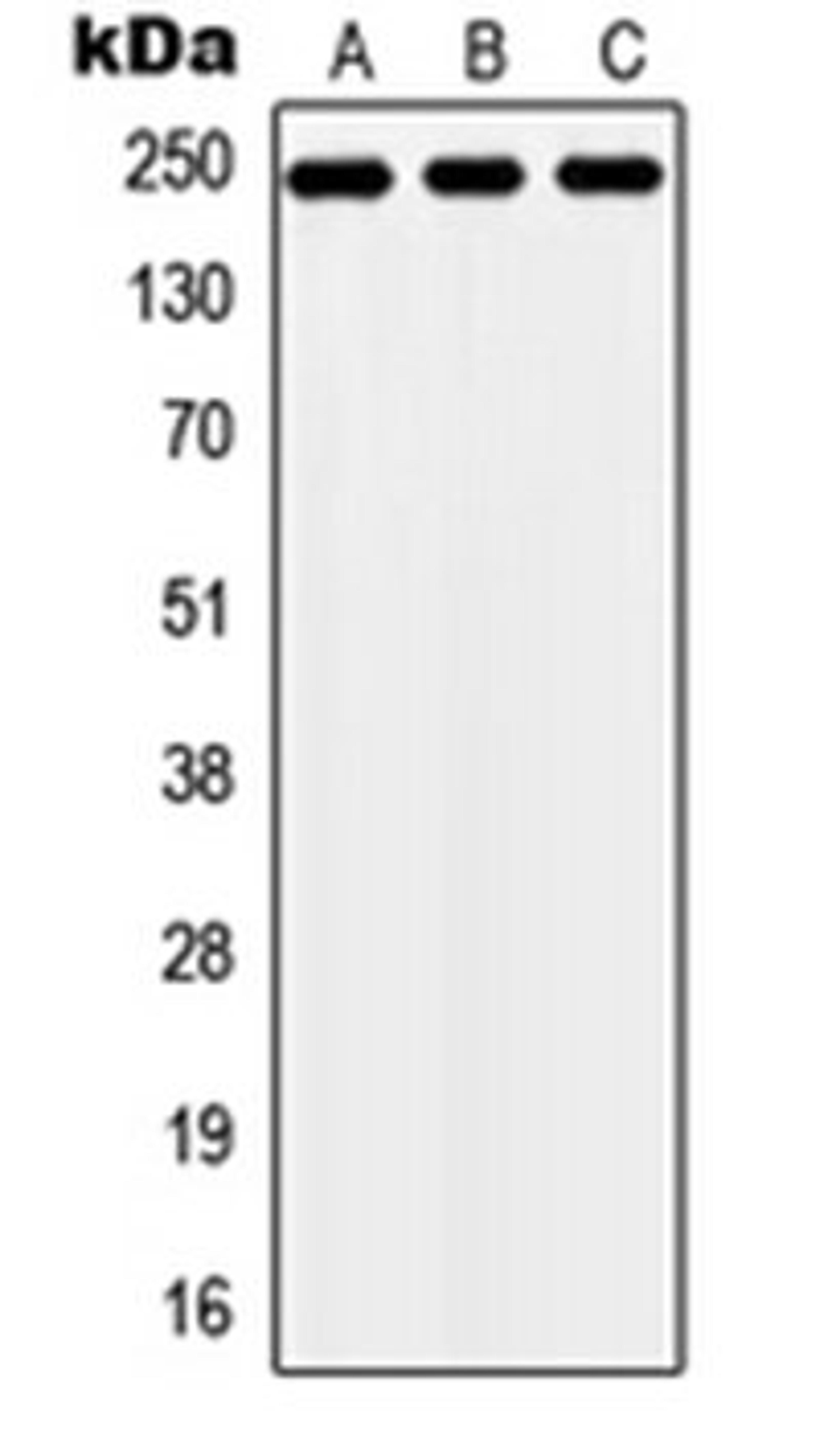 Western blot analysis of HEK293T (Lane 1), NIH3T3 (Lane 2), H9C2 (Lane 3) whole cell lysates using ZNF638 antibody