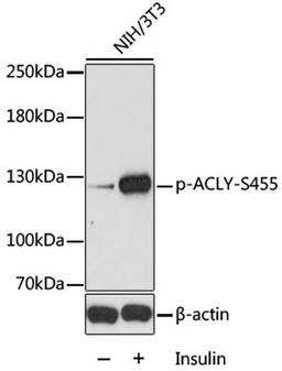 Western blot - Phospho-ACLY-S455 antibody (AP0779)