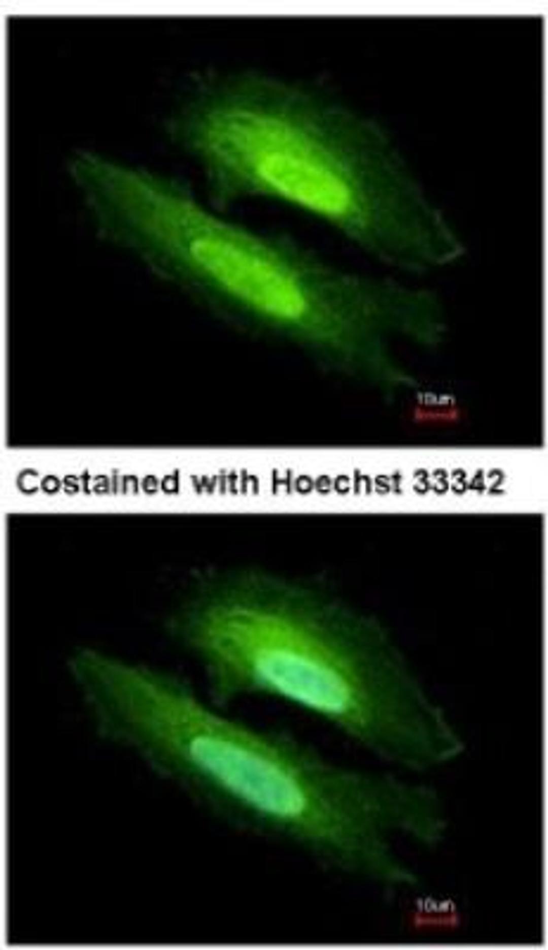 Immunocytochemistry/Immunofluorescence: PDE6D Antibody [NBP1-32730] - Analysis of methanol-fixed HeLa, using antibody at 1:500 dilution.