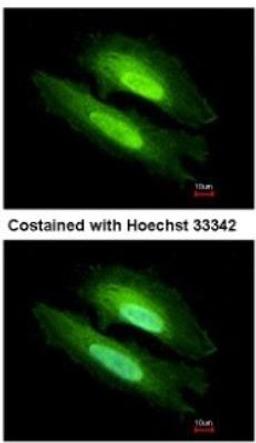 Immunocytochemistry/Immunofluorescence: PDE6D Antibody [NBP1-32730] - Analysis of methanol-fixed HeLa, using antibody at 1:500 dilution.