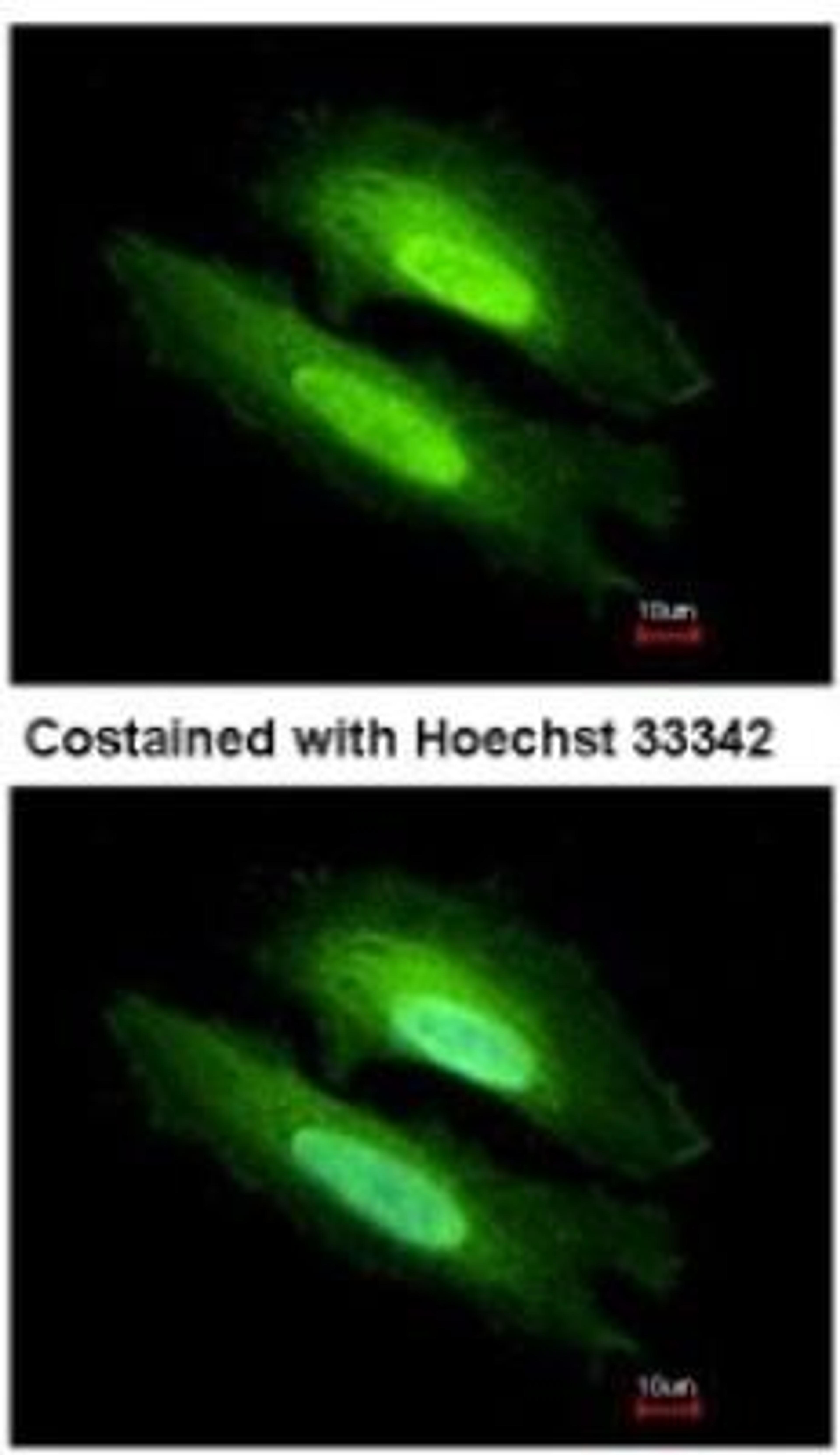 Immunocytochemistry/Immunofluorescence: PDE6D Antibody [NBP1-32730] - Analysis of methanol-fixed HeLa, using antibody at 1:500 dilution.