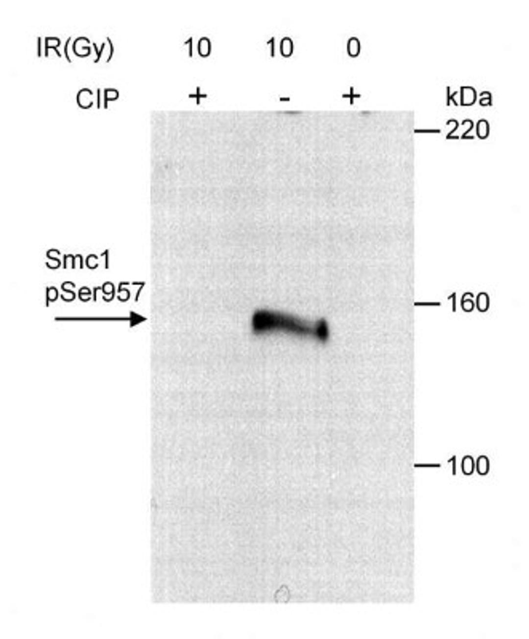 Western Blot: SMC1 [p Ser957] Antibody [NB100-205] - Whole cell extracts from HeLa cells (30 ug/lane) that were irradiated with 10 Gy of ionizing radiation or mock irradiated. Irradiated lysate was then treated with calf intestinal phosphatase (CIP) or left untreated. Antibody used at 0.1 ug/ml.