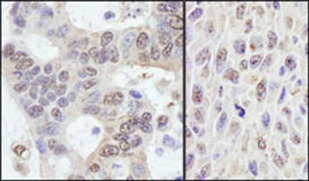 Detection of human and mouse PRKRIR by immunohistochemistry.