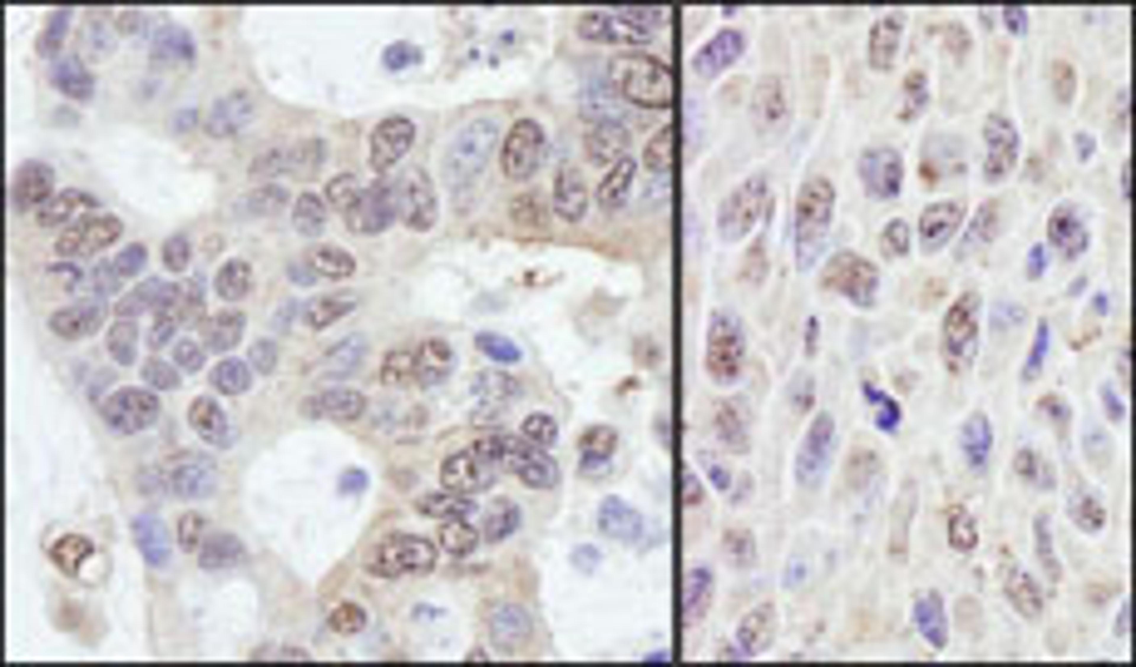 Detection of human and mouse PRKRIR by immunohistochemistry.